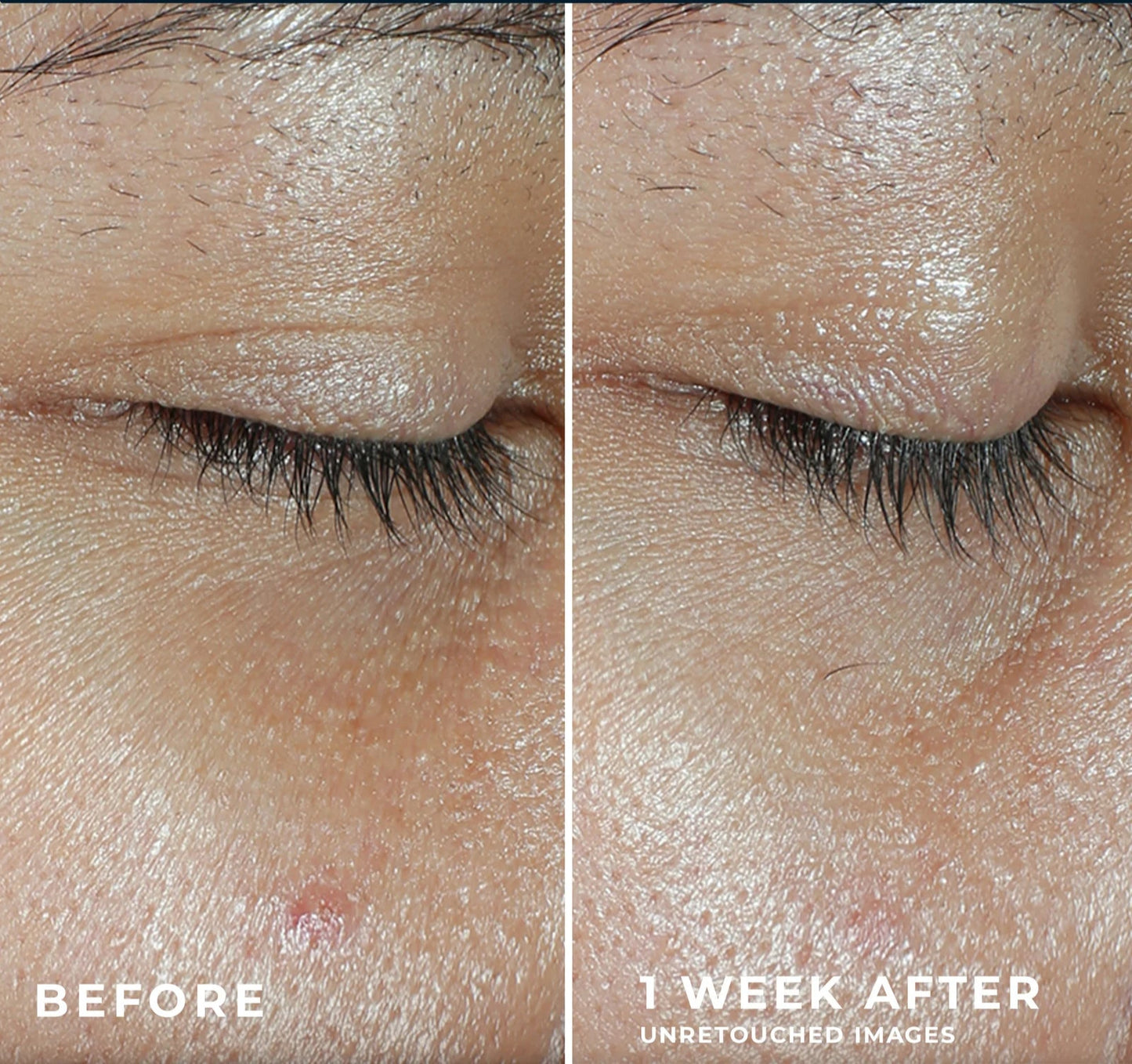 LumiVive™ Multi Correxion® Revive + Glow Eye Balm