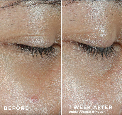 LumiVive™ Multi Correxion® Revive + Glow Eye Balm